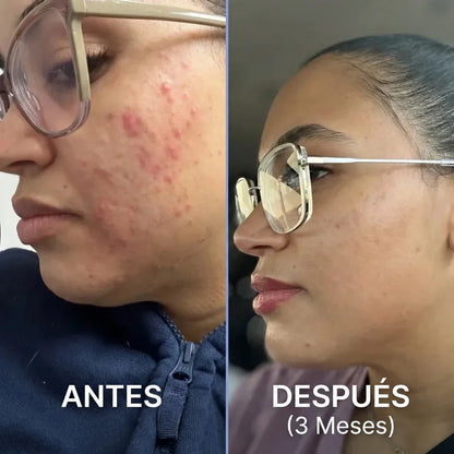 Compra 1 y Llévate 2 - DIM + Bioperine Toplux 60 cápsulas