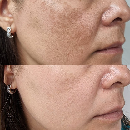 Compra 1 y Llévate 2 | Tónico Facial Ácido Glicólico 7%