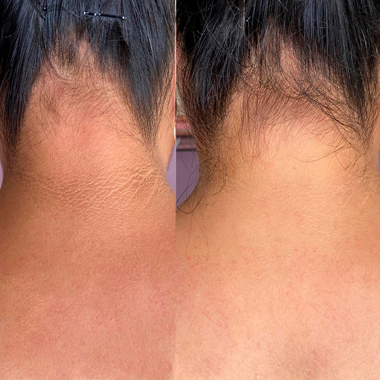 Compra 1 y Llévate 2 | Tónico Facial Ácido Glicólico 7%