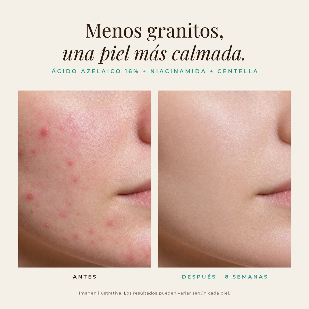 Compra 1 y Llévate 2 - Serum Medicube Ácido Azelaico