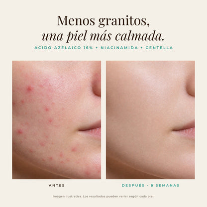 Compra 1 y Llévate 2 - Serum Medicube Ácido Azelaico