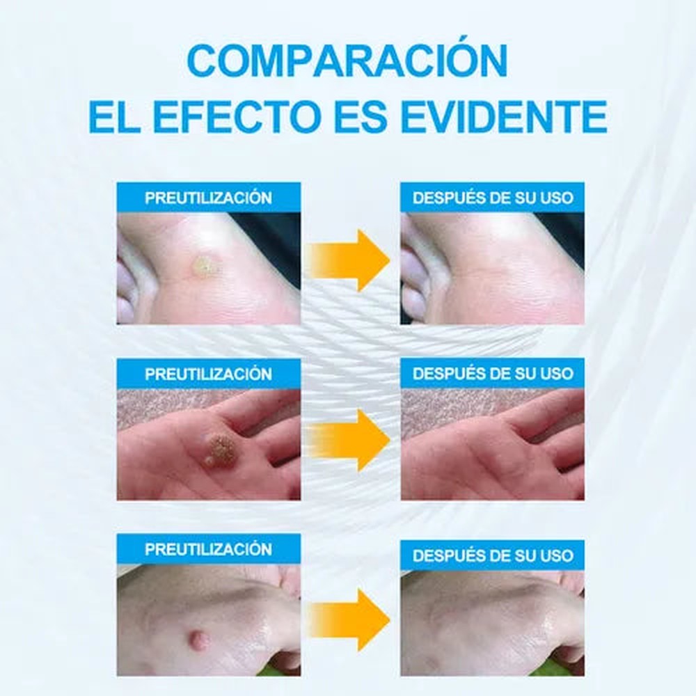 Comparación antes y después del uso del parche en cuello, dedo y pie