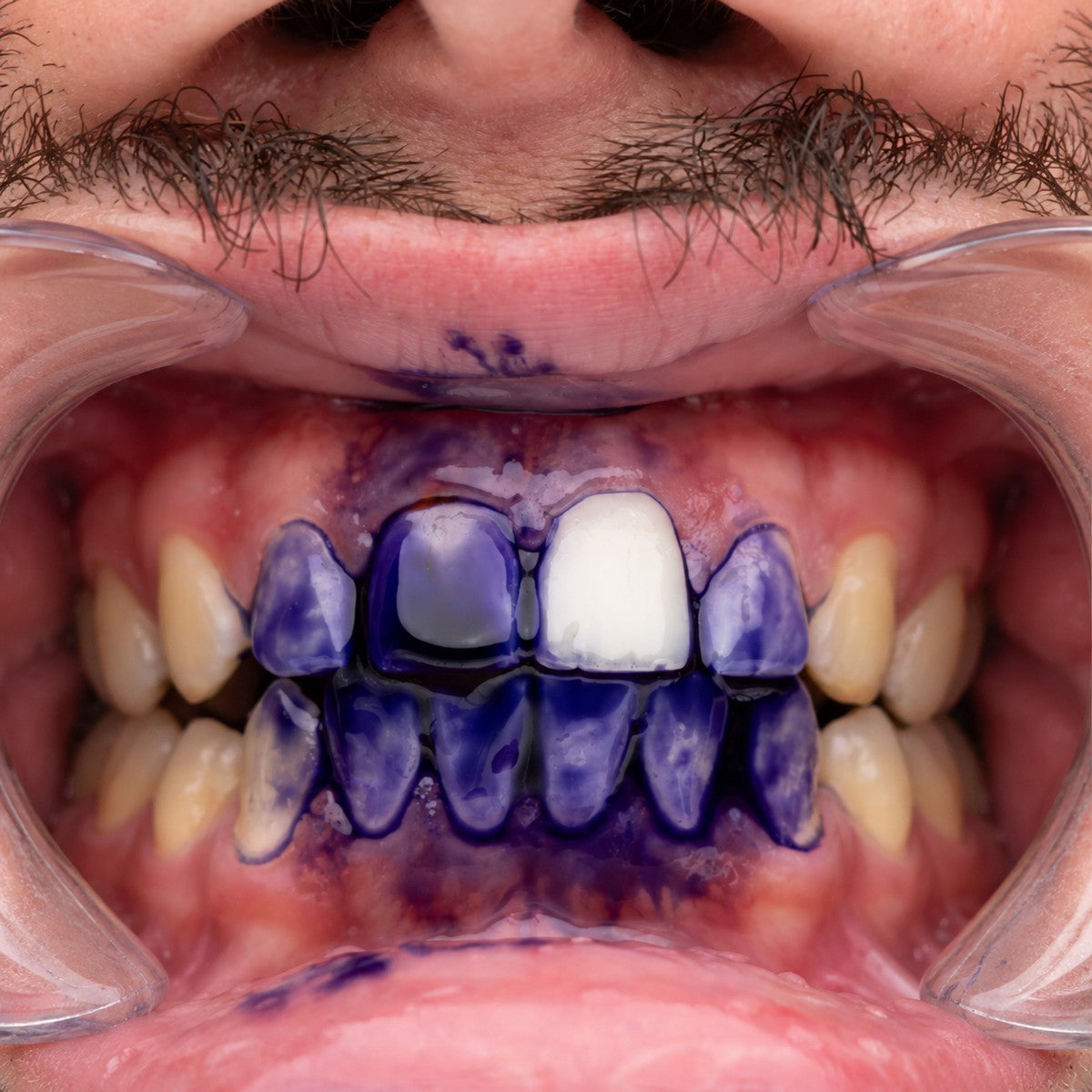 VioletSmile pasta dental morada V34